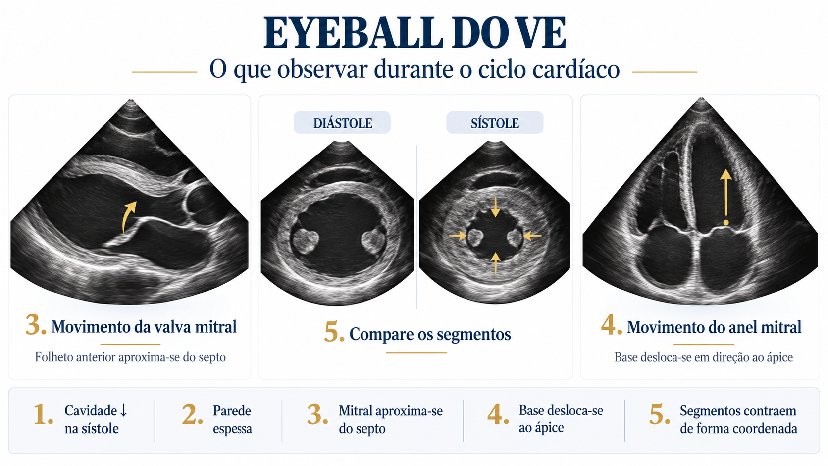 Infográfico com os cinco elementos da avaliação visual da função sistólica do ventrículo esquerdo.