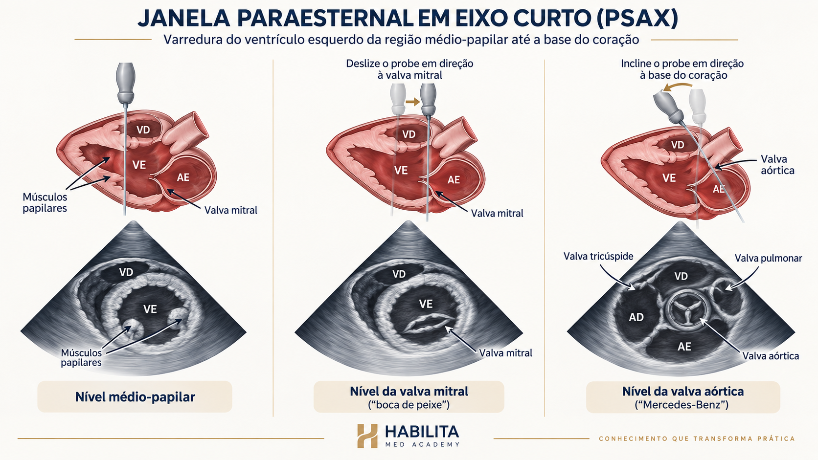 Infográfico esquemático da janela paraesternal de eixo curto em três níveis: valva aórtica, valva mitral e músculos papilares, com desenhos anatômicos correspondentes.