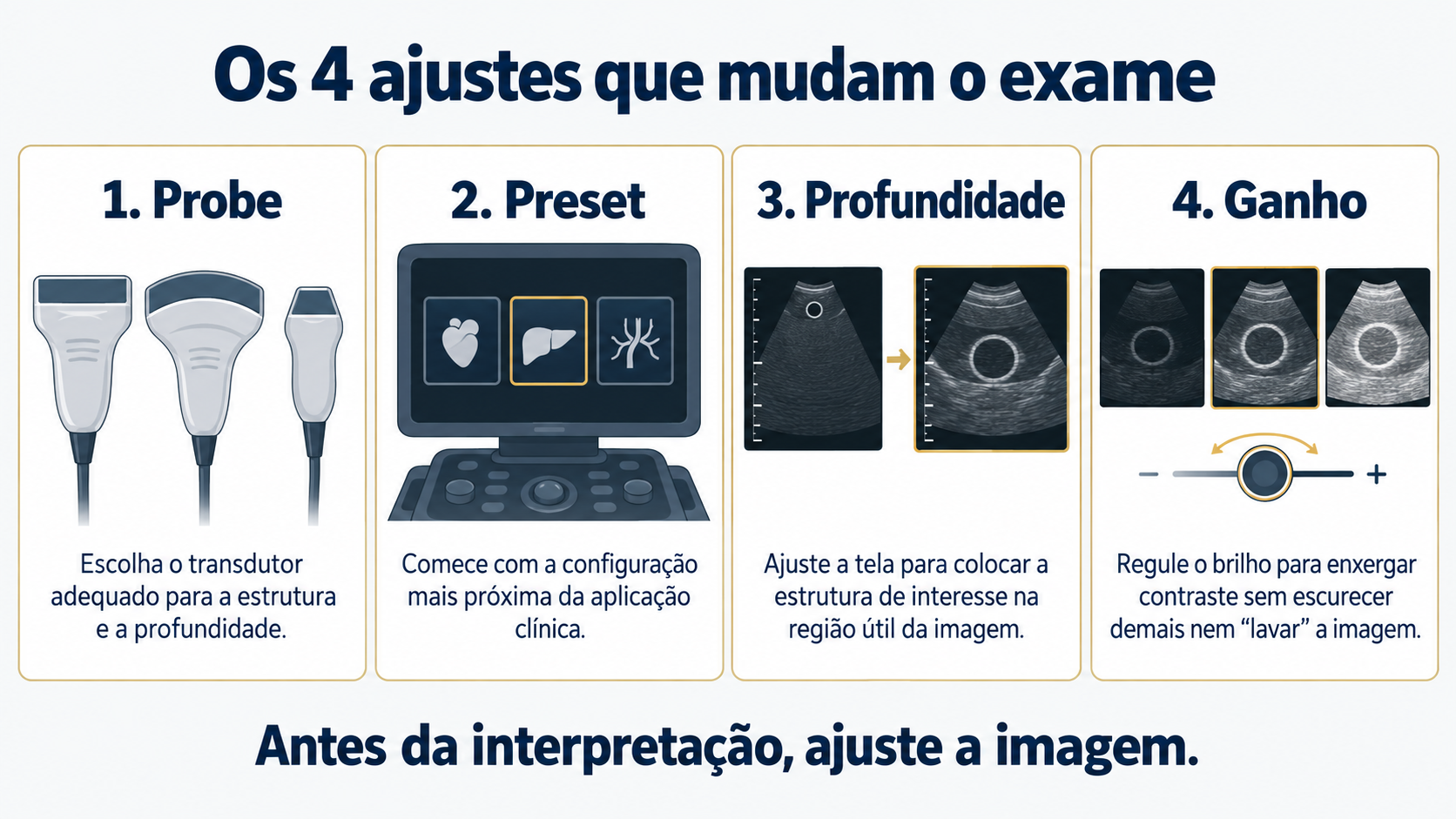 Infográfico com os quatro ajustes fundamentais da knobology: probe, preset, profundidade e ganho.