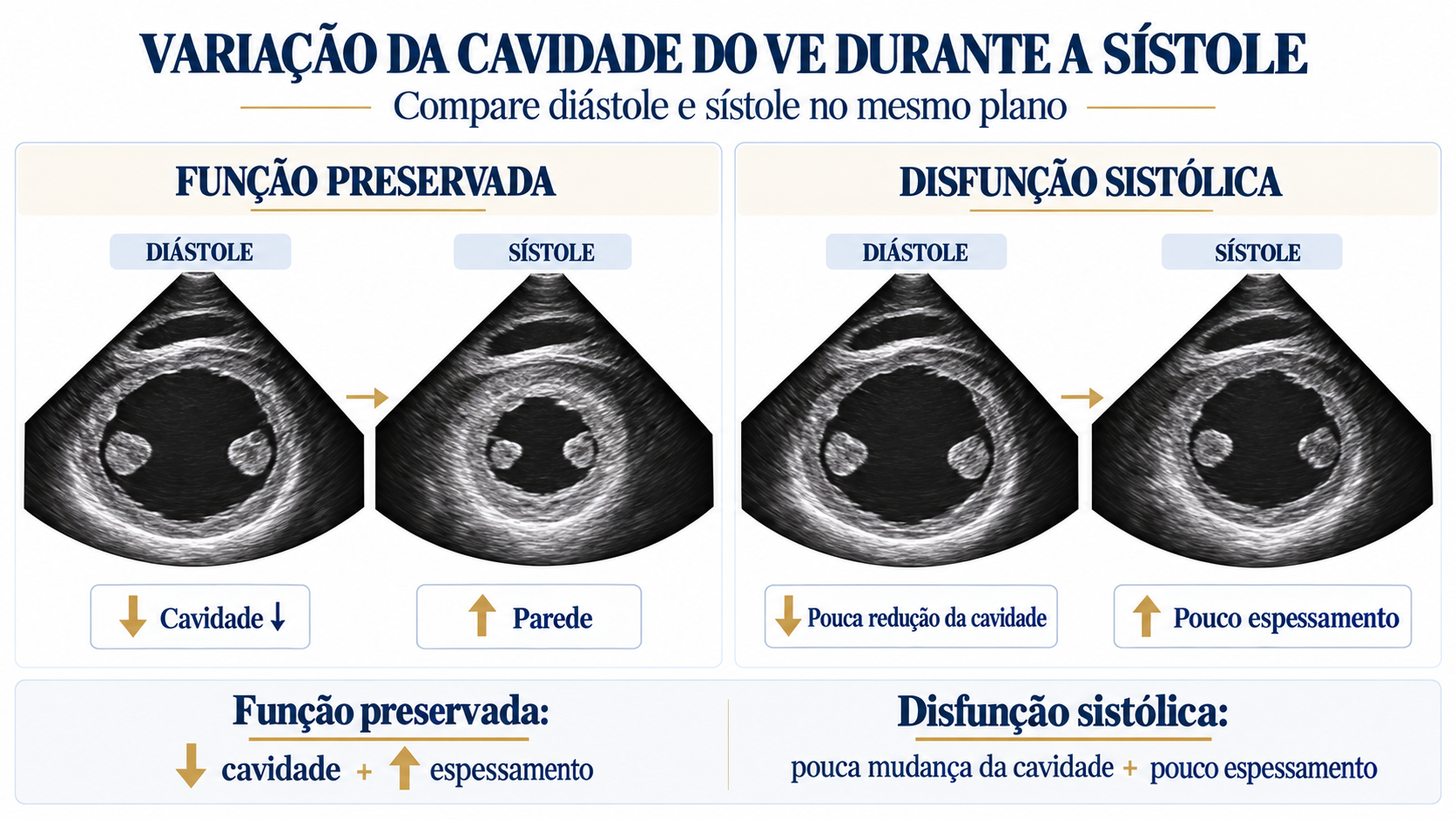 Comparação em eixo curto entre ventrículo esquerdo com função preservada e ventrículo esquerdo com disfunção sistólica.